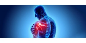 ARE YOU SUFFERING FROM ARTHRITIS PROBLEM?